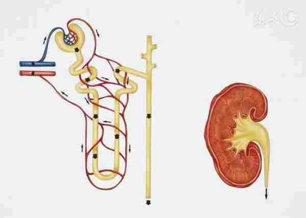 肾不好两大主要原因|肾脏|肾积水